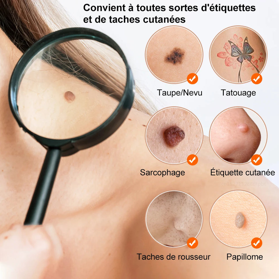 Stylo Plasma Professionnel – Élimination des Imperfections Cutanées