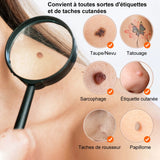 Stylo Plasma Professionnel – Élimination des Imperfections Cutanées
