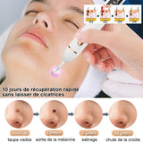Laser Plasma Pen Black Dots Freckles Mole Wart Remover Pen Dark Spot Remover For Face Electric Pimples Tattoo Skin Tag Removal