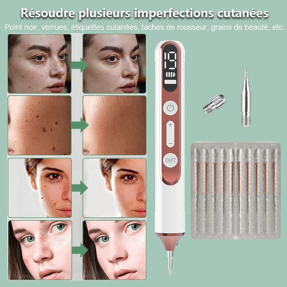 Stylo Plasma Professionnel – Élimination des Imperfections Cutanées
