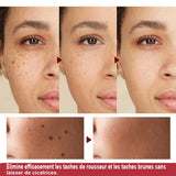 Laser Plasma Pen Black Dots Freckles Mole Wart Remover Pen Dark Spot Remover For Face Electric Pimples Tattoo Skin Tag Removal