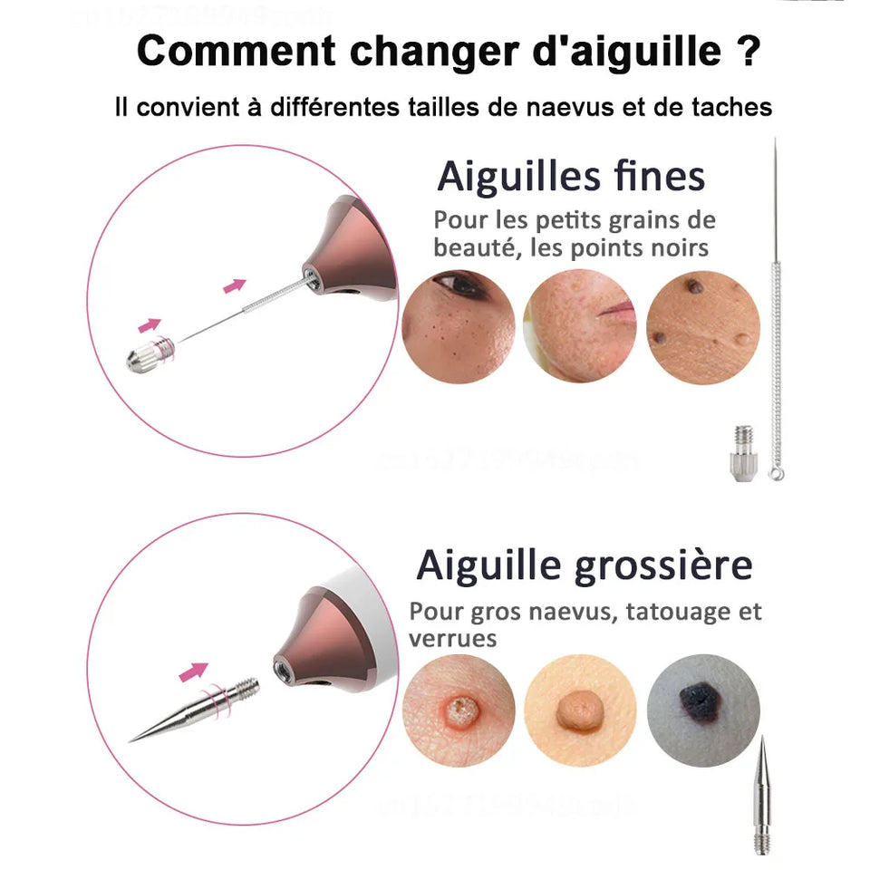 Stylo Plasma Professionnel – Élimination des Imperfections Cutanées